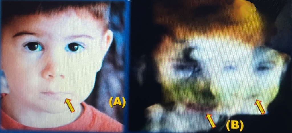 Little Samuel Transimage